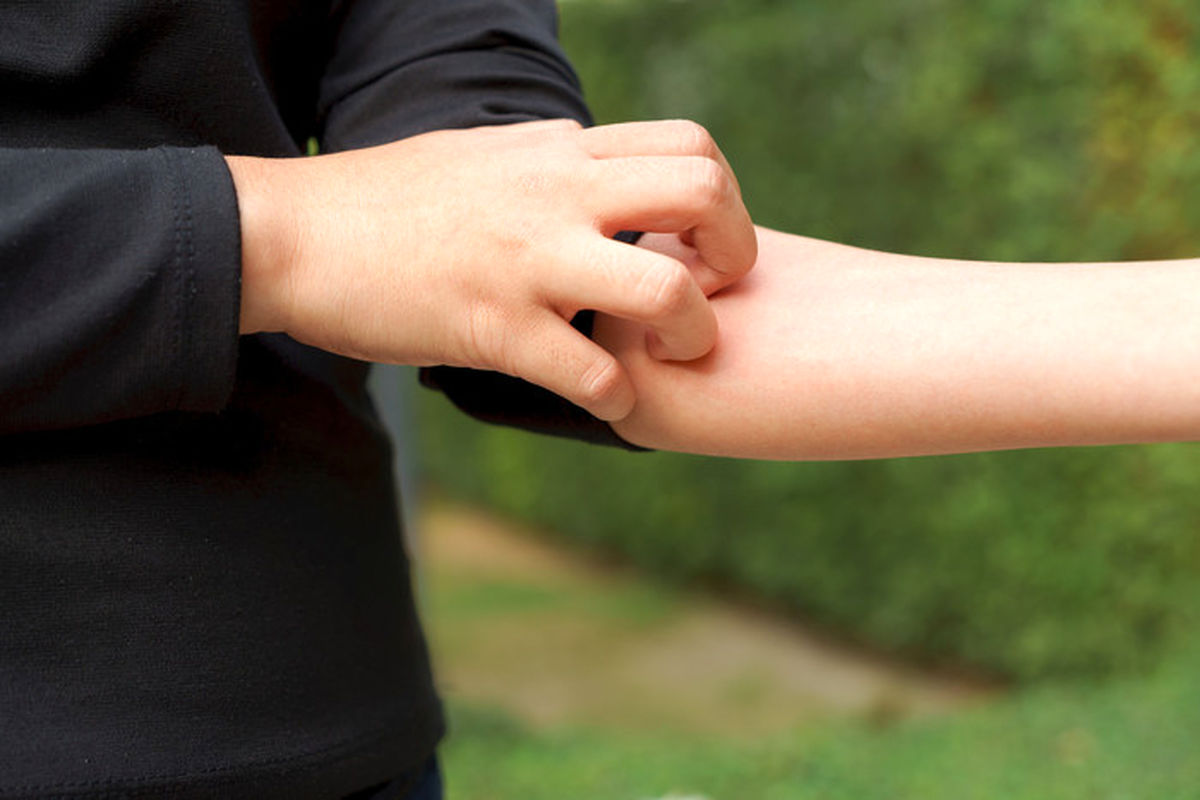 اگر پوستتان این نشانه ها را داشت حتمی جدی بگیرید