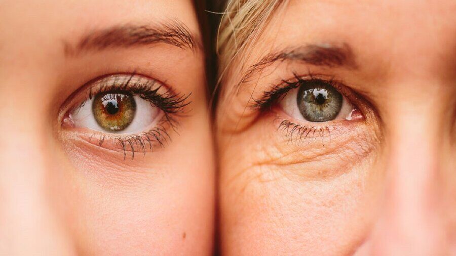 رفع چین و چروک‌های صورت با این مواد غذایی
