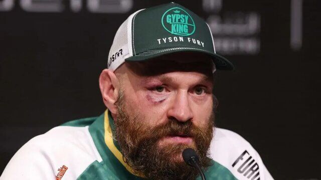 تایسون فیوری برای پنجمین بار وداع کرد

