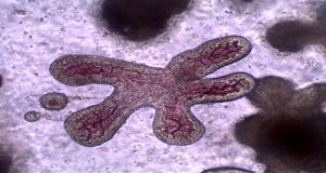 سازمان بهداشت جهانی هشدار داد:با ویروس مرگبار نیپا آشنا شوید