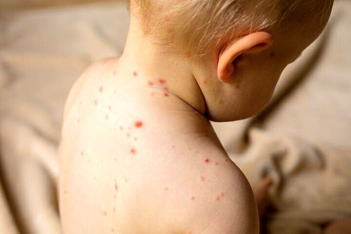 
اگر دچار آنفلوانزا شدیم چی بخوریم؟