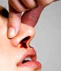 علت خونریزی بینی بیشتر کودکان نسبت به بزرگسالان چیست؟