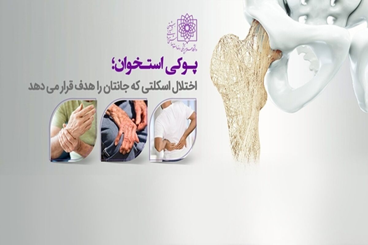 معرفی خطرات پوکی استخوان