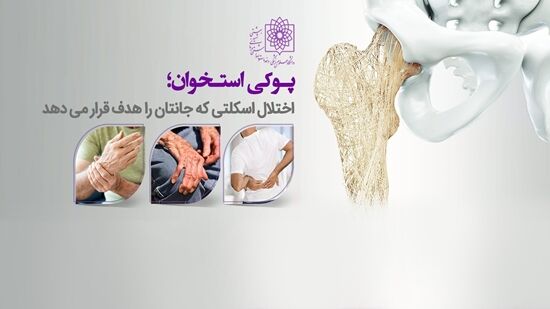معرفی خطرات پوکی استخوان