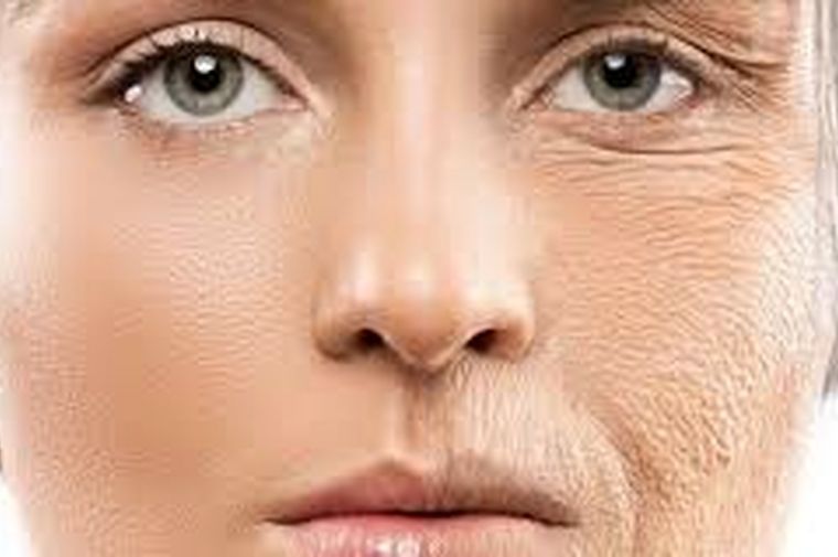 ۷ نشانه‌ پوستی که خبر از بیماری جدی می‌دهند