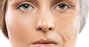 ۷ نشانه‌ پوستی که خبر از بیماری جدی می‌دهند