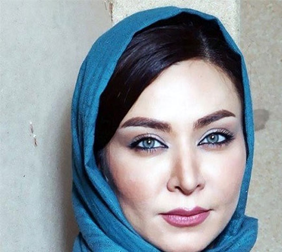فقیهه سلطانی را قبل و بعد از عمل زیبایی ببینید/ تصاویر