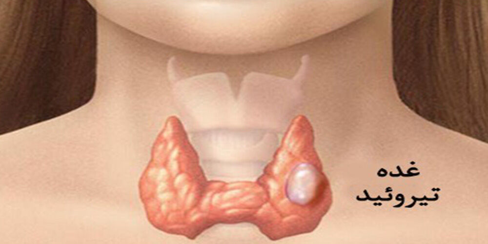 علائم مخفی ابتلا به اختلالات تیروئید 