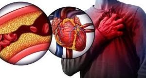 نشانه های روی ناخن که یعنی کلسترول خون شما بالا است