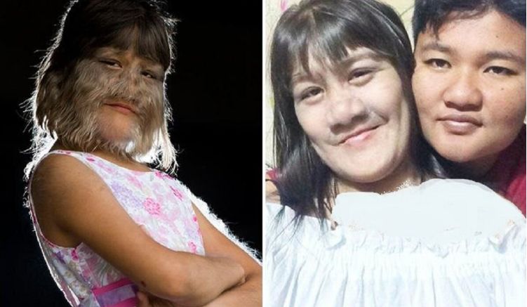 دختر گرگ نمای پرمو عشق زندگی اش را پیدا کرد+عکس همسر