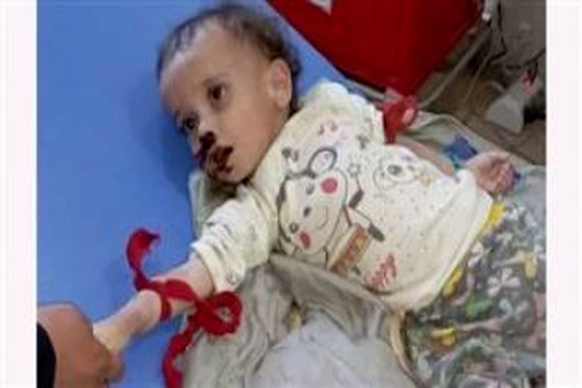 سرنوشت غم انگیز دختر ۲ ساله