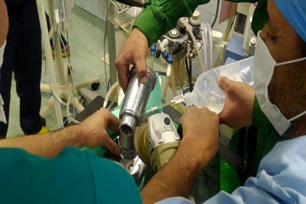 حادثه هولناک برای دختر خردسال/ چرخ گوشت 4 انگشت دختربچه را قطع کرد