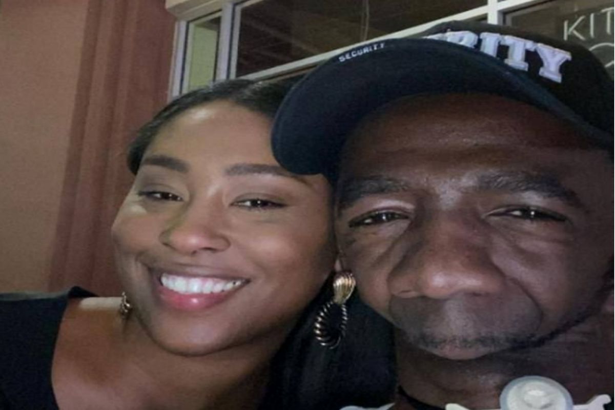 ازدواج باورنکردنی مردی که فک و چانه ندارد با این زن زیبارو +عکس