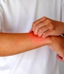 به این دلیل مهم نگران گزگز دست تان باشید