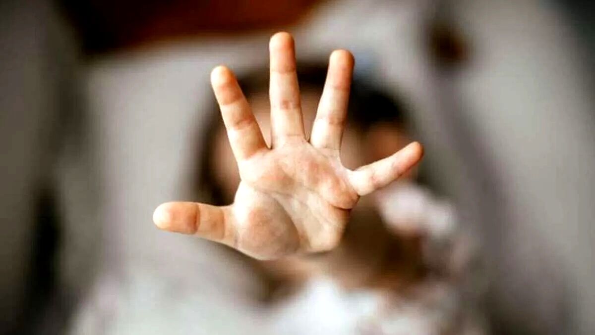 شکنجه وحشتناک پسربچه به دست مادر بی‌رحمش 