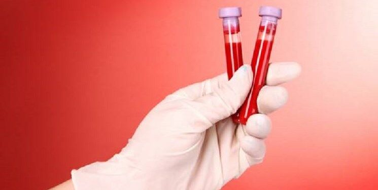 حجامت باعث معافیت یک ساله داوطلب از اهدای خون می‌شود