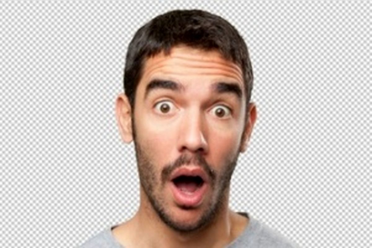 تصویری عجیب و باورنکردنی از کودک دختری که دو دست اضافه روی سینه اش دارد/ عکس