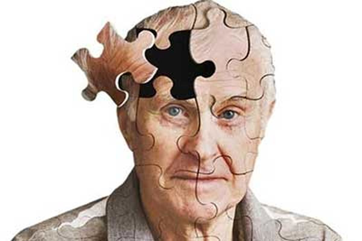 مشکلات آلزایمر در این افراد ۵ برابر بیشتر است!