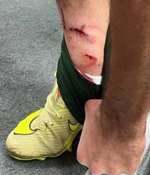 این سه صحنه داوری صدای پرسپولیس و حریفش را درآورد