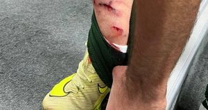 این سه صحنه داوری صدای پرسپولیس و حریفش را درآورد