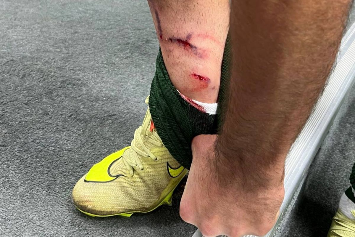 این سه صحنه داوری صدای پرسپولیس و حریفش را درآورد