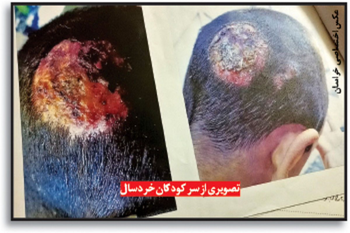 کودک‌آزاری مردی که گوشت الاغ می‌فروخت فاش شد