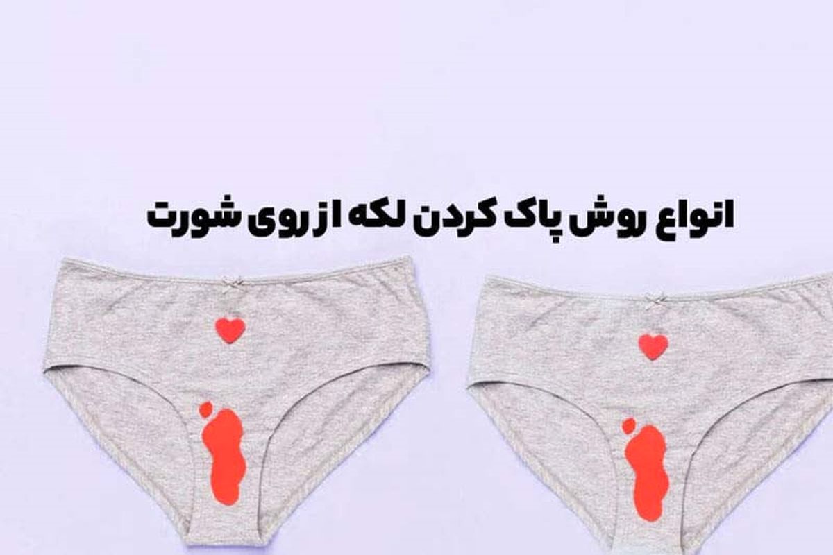 انواع روش پاک کردن لکه از روی شورت